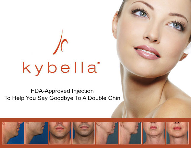 kybella image